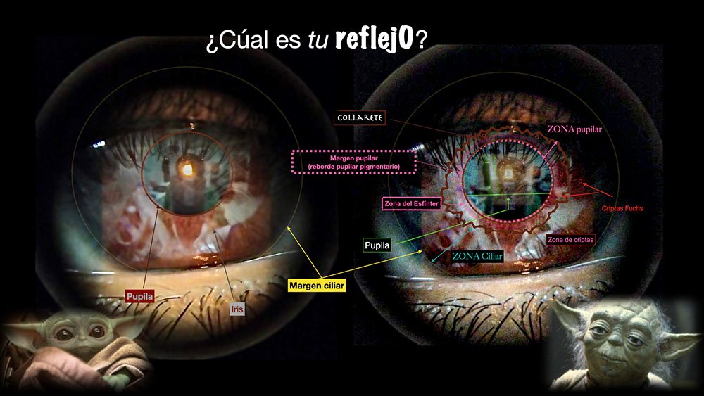 Reflejo
