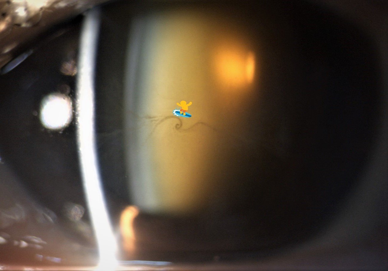 Cornea verticilata surfista