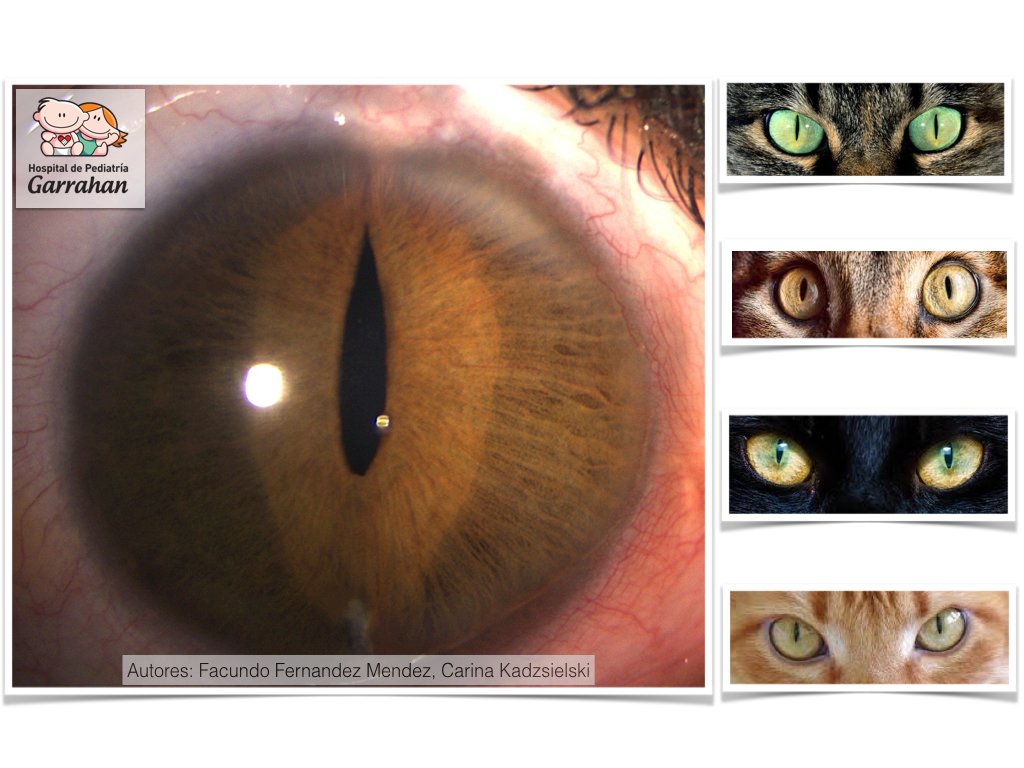 Ojo de gato