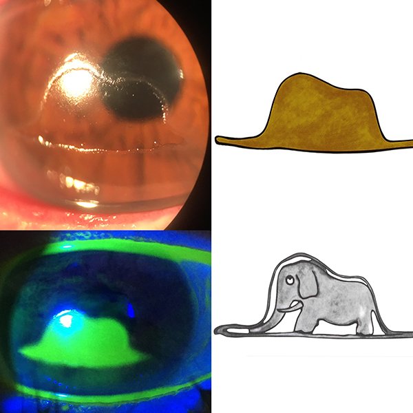 The essential is invisible to the eyes