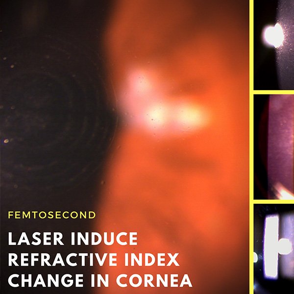 LASER Induce Refractive Index in cornea.