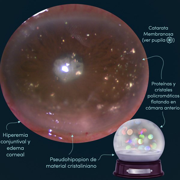 Snowglobe: Glaucoma Facolítico de catarata en árbol de navidad