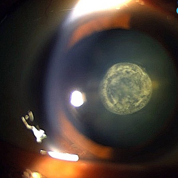 Luna Llena
