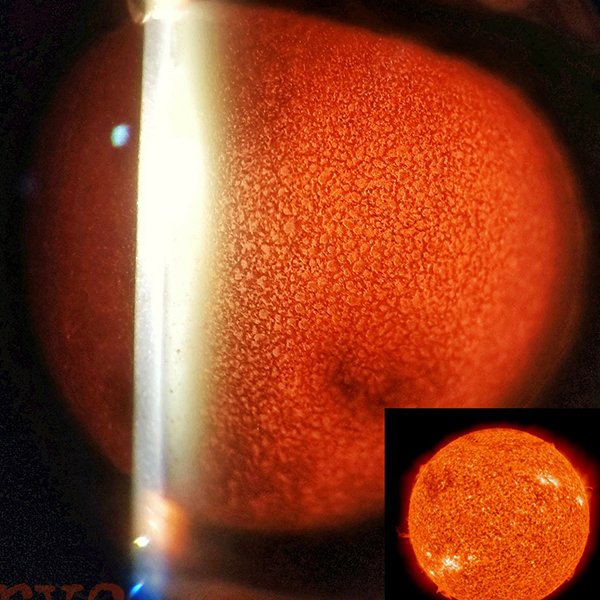 Sol
