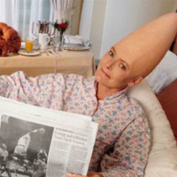 Conehead
