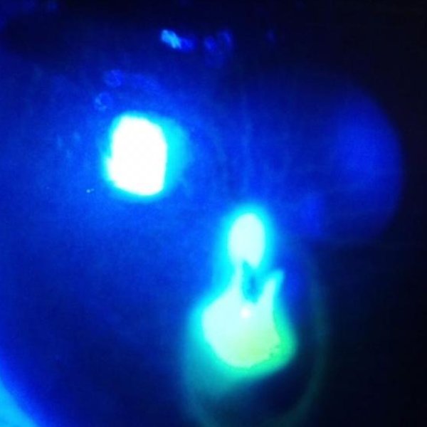Traumatismo ocular abierto