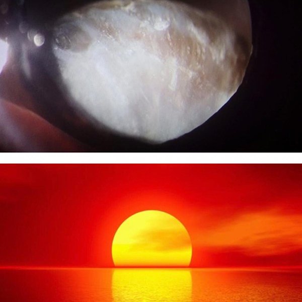 Puesta de sol