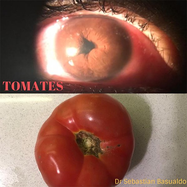 Tomates