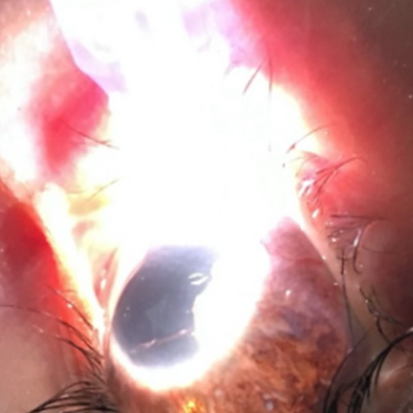 El iluminado