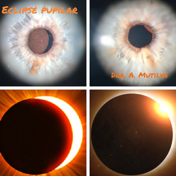 Eclipse pupilar