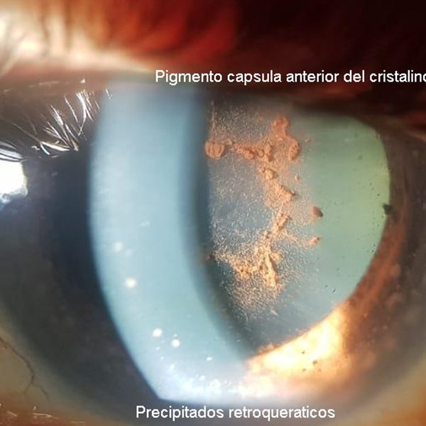 Cinturon de asteroides