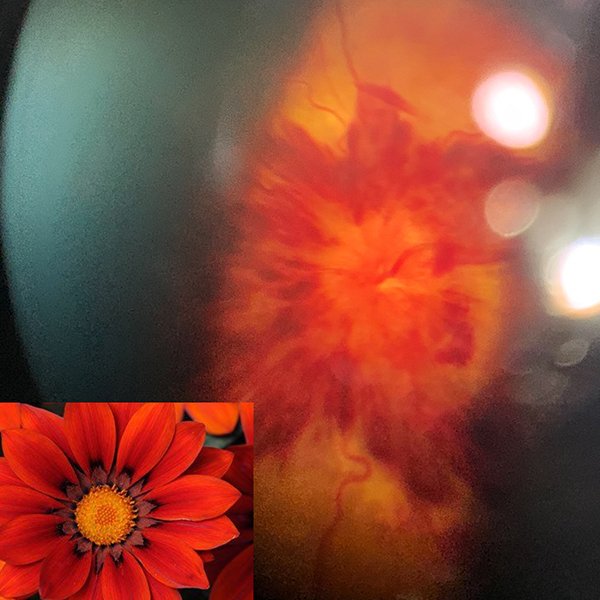 Flor de retin