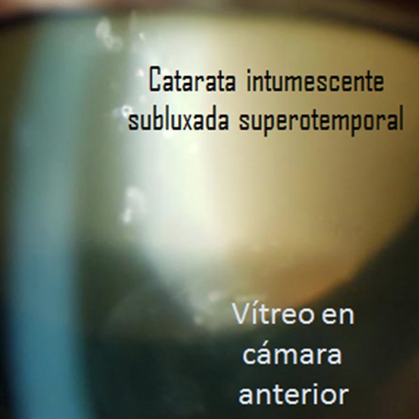 SALI AHI MARAVILLA