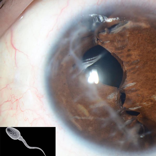 Spermatozoom