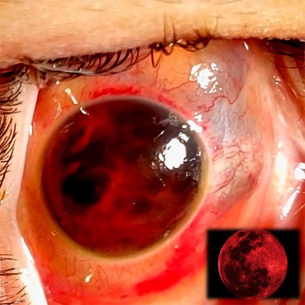 Luna Roja