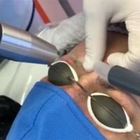 Introducción a la Eliminación Laser de Tatuajes