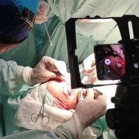 Logra la mejor versión de tu paciente - Blefaroplastia estructurada