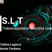 SLT