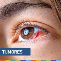 Un tumor: mi diagnóstico