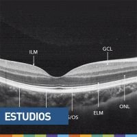 OCT a través de casos de la práctica diaria
