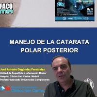 Manejo de la catarata polar posterior