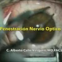 Fenestración de Nervio óptico