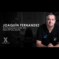 Lentes multifocales: Más allá de lo que dice el Marketing