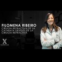 Cirugía refractiva de la catarata después de la cirugía refractiva