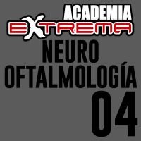 Neurooftalmología 4
