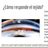 ¿Qué puedo esperar de un SLT?