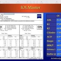 Queratocono y Catarata