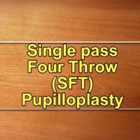 ASCRS 2018-SFT- Final-Animation, technique, glaucoma