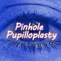 ASCRS 2019 - Pinhole Pupilloplasty